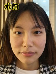 -素美医疗美容·西南眼鼻整形·修复基地