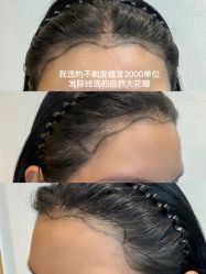 -雍禾植发全国连锁