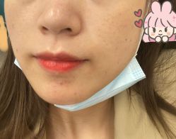 体验后-美莱医疗美容医院