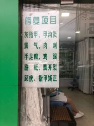 -德哥灰指甲脚气甲沟炎跖疣护理