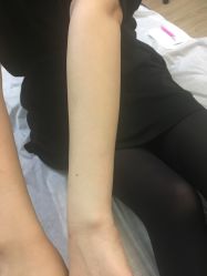 点击看大图 -日本直营PURE专业脱毛中心