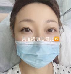 点击看大图 -Verywang半永久纹眉•仪器野生眉