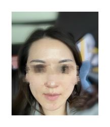 体验前-深圳春天阳光医院·轮廓抗衰中心