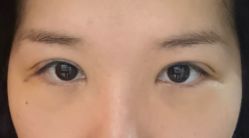 体验后-杭州美莱医疗美容医院