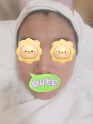 -苗方清颜专业祛痘连锁机构