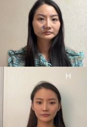-Yestar 嘉兴艺星医疗美容医院