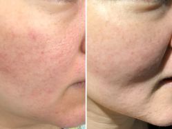-SKINIST丽铂医疗美容