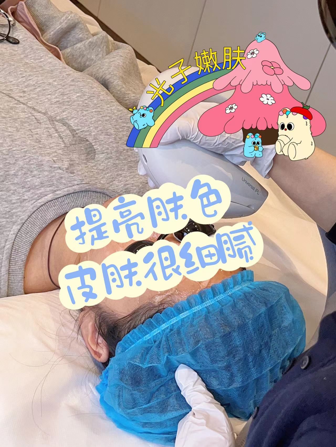 找正规机构做光子嫩肤,效果真的太赞了