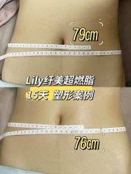 -Lily纤美·科技减脂中心