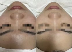 点击看大图 -SKIN79皮肤管理中心