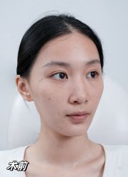 -Yestar重庆艺星医疗美容医院