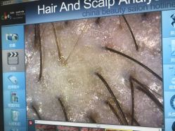 -雍禾植发全国连锁