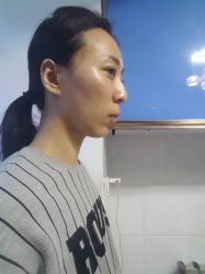 点击看大图 体验前-鑫元辰医疗美容整形
