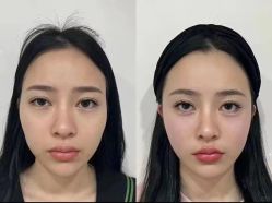 点击看大图 -上海伊莱美医疗美容医院