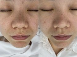 -蕾特恩专业祛痘·皮肤管理