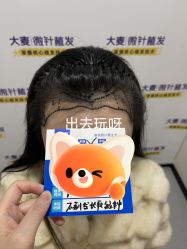 -大麦微针植发全国连锁