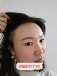 -雍禾植发全国连锁