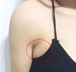 -丽减美瘦吧·减肥瘦身