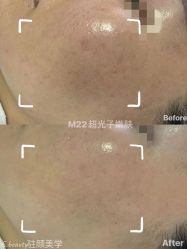 点击看大图 -E.beauty驻颜·痘敏肌调理中心