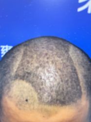 -雍禾植发全国连锁