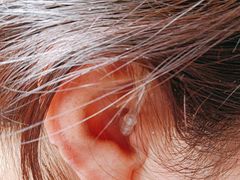 -自然之声助听器·呼吸机(公园路店)