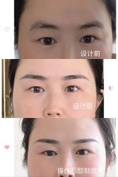 -久匠半永久纹眉