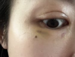 -慕颜医疗美容·皮肤微整 抗衰
