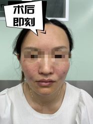 -素美医疗美容·西南眼鼻整形·修复基地