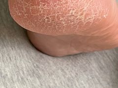 -世龙世家甲沟炎·灰指甲·嵌甲矫正·修脚(武侯区双楠店)