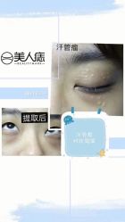 -美人痣全国连锁