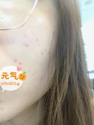 -上海玫瑰医疗美容医院