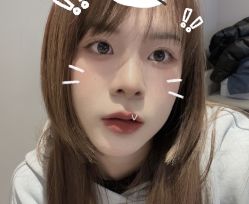 -成都西区医院整形美容