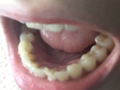 -Dr.Z dental仁康种植矫正中心