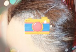 -大麦微针植发全国连锁