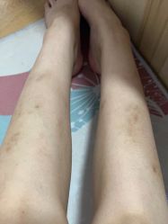 体验前-空军总医院激光整形美容中心