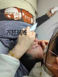 -万阡国际专业祛斑·祛痣·祛疤连锁