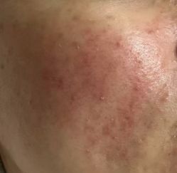 点击看大图 -MLP美丽派·问题肌疗愈中心