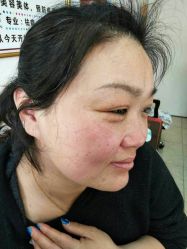 -北京美痣堂古方祛痣斑疣瘊
