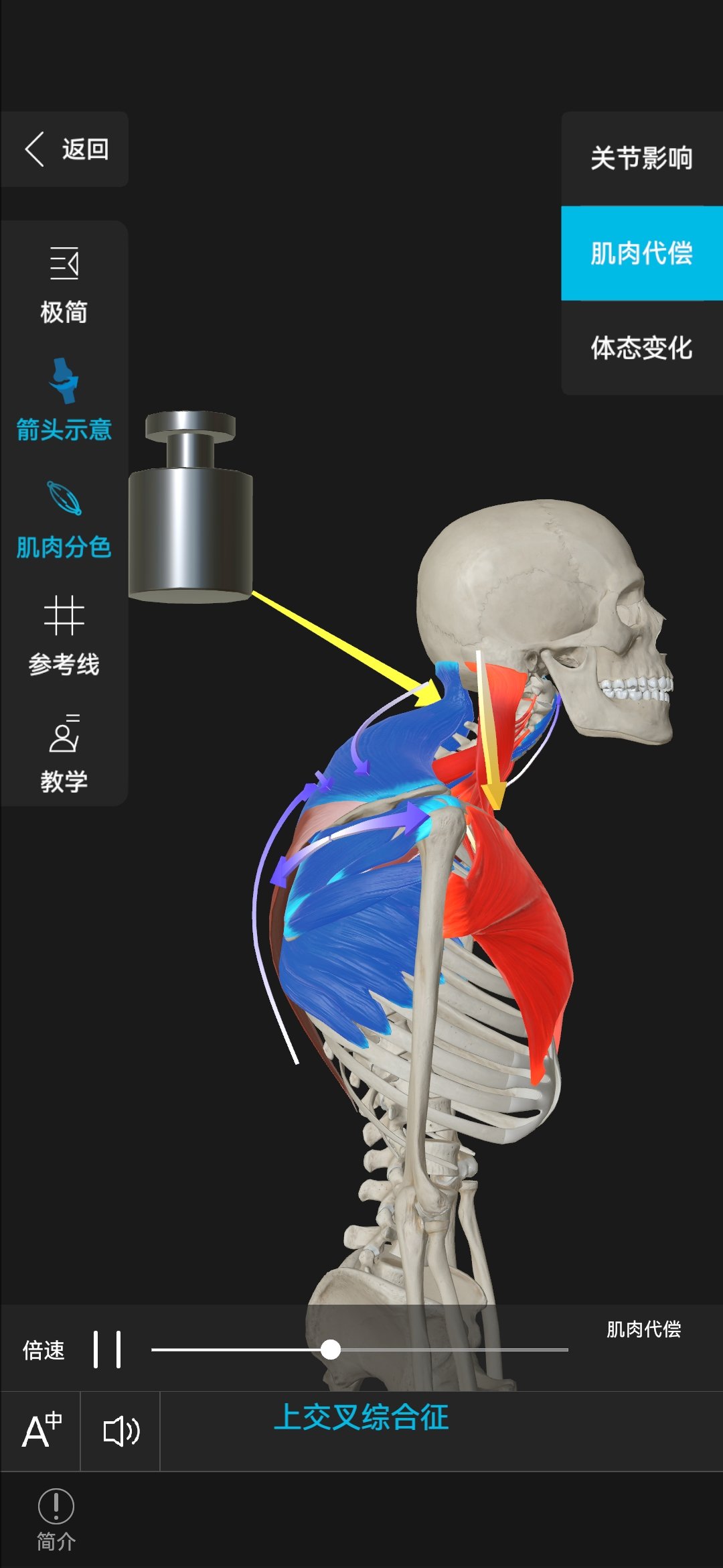 上交叉综合症图图片