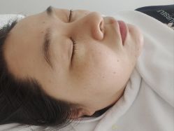 体验前-康美贞·痘肌养护管理中心