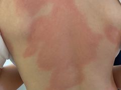 -安徽医科大学第一附属医院(绩溪路院区)