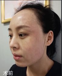 点击看大图 体验前-脸博士医疗美容·眼鼻整形·抗衰中心