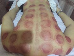 -益友堂盲人推拿正骨穴位按摩工作室