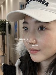 -北京米扬丽格医疗美容·联合丽格鼻整形中心