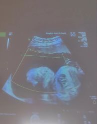 -郑州万安妇产医院