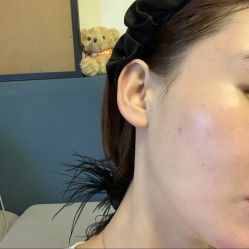 点击看大图 体验后-上海首尔丽格医疗美容医院
