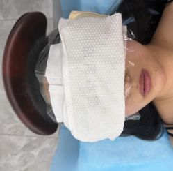 -天津健丽·去眼袋医疗美容机构