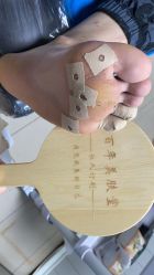-百年美肤堂祛痦痣祛斑祛疣
