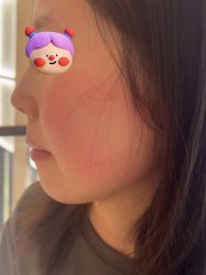 -四川米兰柏羽医学美容医院