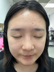 -小忠丽格医美